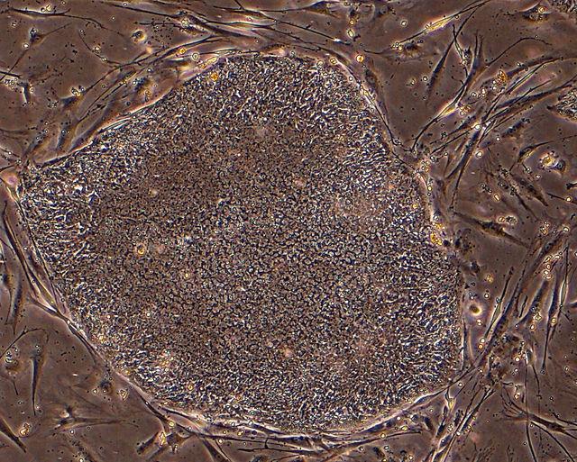 Menschliche induzierte pluripotente Stammzellen (iPS) wachsen unter Laborbedingungen