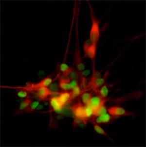 Cellules nerveuses productrices de dopamine