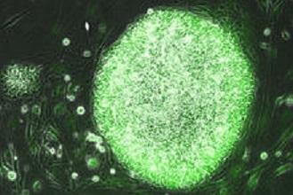 Cellule pluripotenti