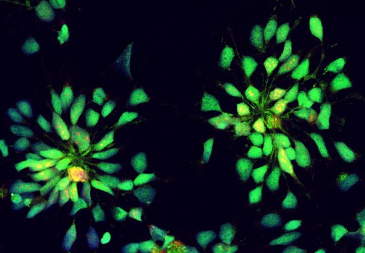 neural stem cells from pluripotent cells