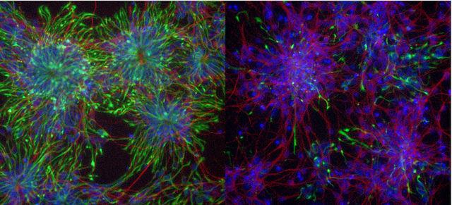 Differentiating neurons