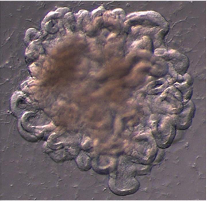 Human embryonic budding lung organoid