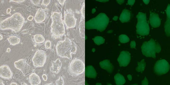 células madre embrionarias
