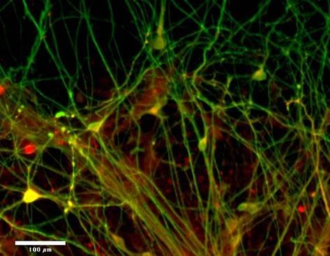 Neurons (nerve cells) made in the lab from human embryonic stem cells