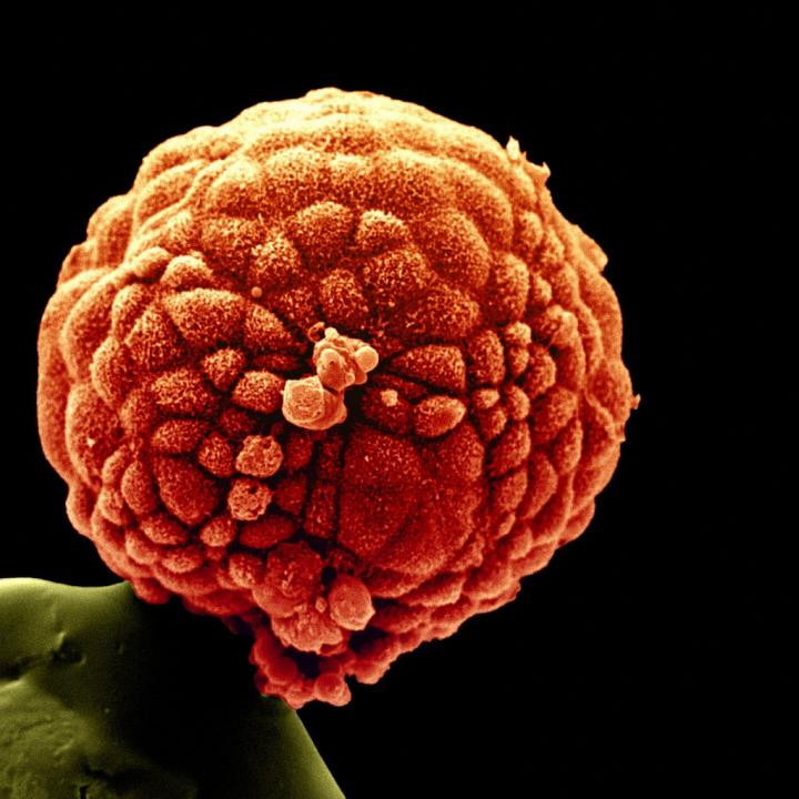Ludzka blastocysta na łebku od szpilki