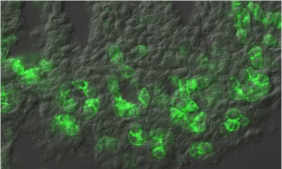 Grün Fluoreszenz-markierte Stammzellen in der sich entwickelten Lunge.