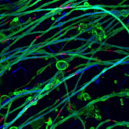 Myelin surrounding axons