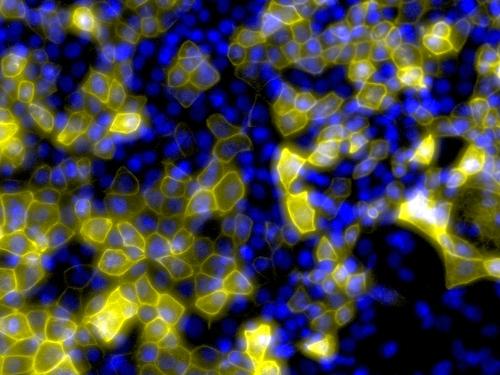 Skin cells emerging from embryonic stem cells