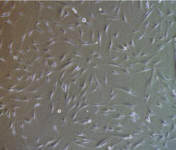 Human mesenchymal stem cells 
