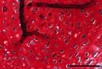 Les cellules du cartilage fabriquées à partir de cellules souches mésenchymateuses