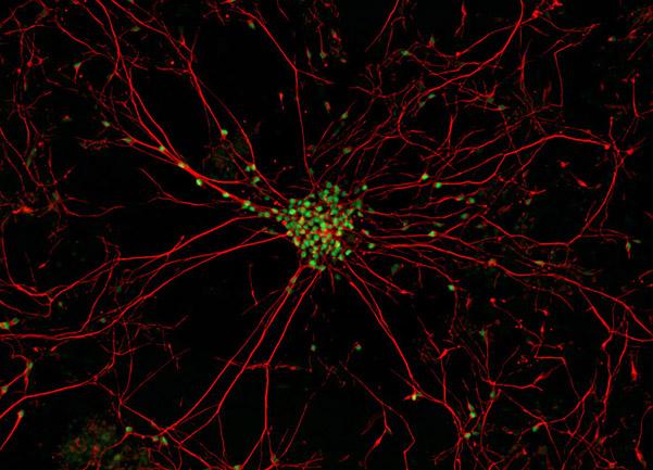 Neurony ruchowe stworzone z komórek iPS uzyskanych od pacjentów z ALS.