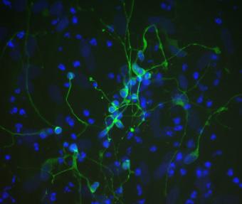 Cellules de peau (cutanées) qui ont été reprogrammées en neurones