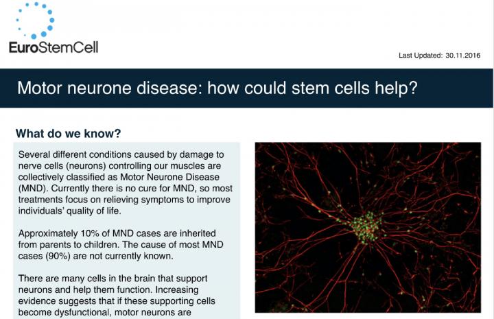 New test zeroes in on motor disease