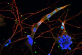 Mithilfe der Stammzellen können im Labor Nervenzellen, wie hier gezeigt, gezüchtet werden.