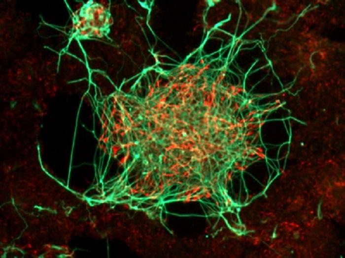Les neurones produits à partir de cellules souches embryonnaires