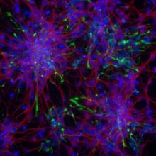 Neuroni coltivati a partire da cellule staminali embrionali.