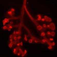 Komórki macierzyste płuc