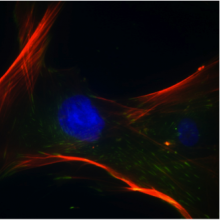 Menschliche mesenchymale Stammzellen