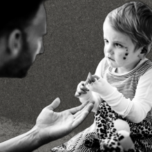 Child with EB in the clinic 