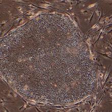 Microscopy image of iPS cells