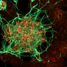 Les neurones produits à partir de cellules souches embryonnaires