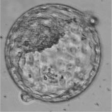 Human blastocyst at 6 days old