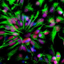 Neural stem cells