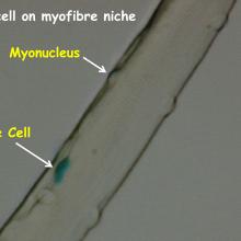 Satellite cell on muscle stem cell