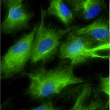 Fibroblasts transformed into induced thymic epithelial cells (iTEC) in vitro; iTEC are shown in green.