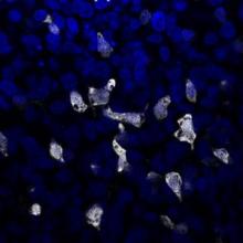 producing beta cells from stem cells