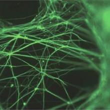 neurons grown in the lab