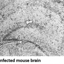 Zika virus in mouse brain