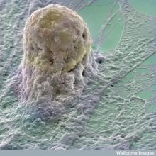 Let's Talk Stem Cells